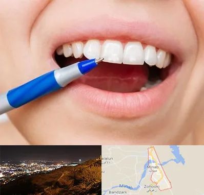 دندانسازی ارزان در میناب
