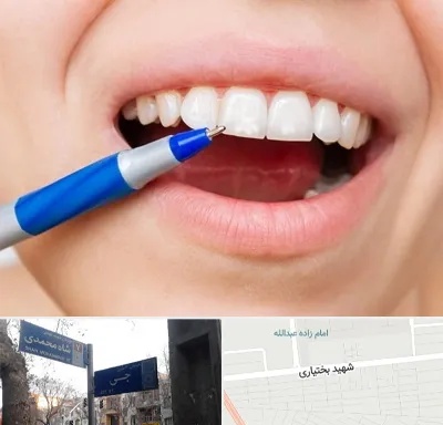 دندانسازی ارزان در سی متری جی