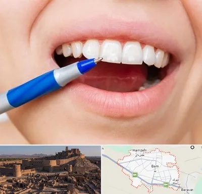 دندانسازی ارزان در بم