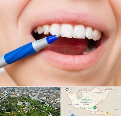 دندانسازی ارزان در شهرکرد