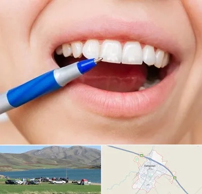 دندانسازی ارزان در دهگلان