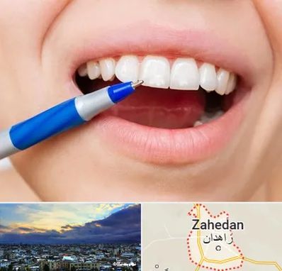 دندانسازی ارزان در زاهدان