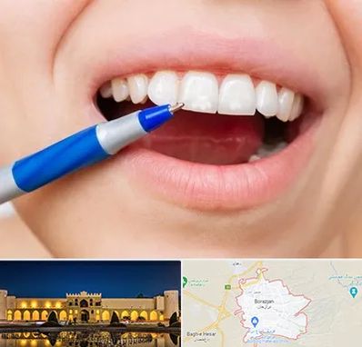 دندانسازی ارزان در برازجان