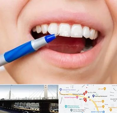 دندانسازی ارزان در پارک وی 