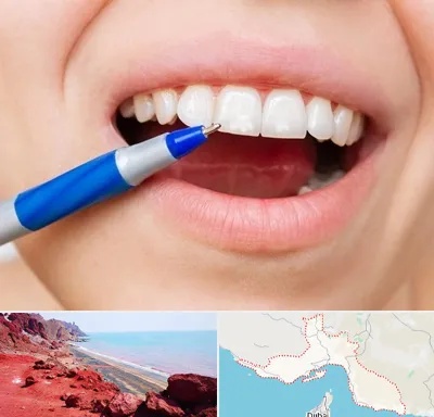 دندانسازی ارزان در هرمزگان