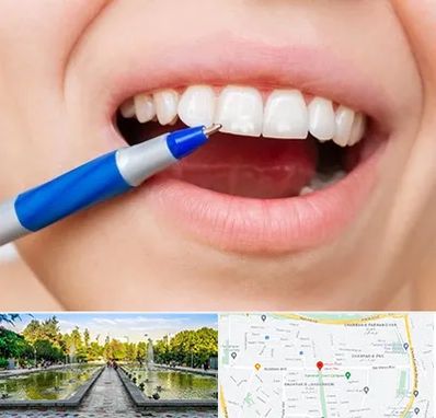 دندانسازی ارزان در سرسبز 