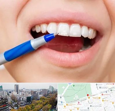 دندانسازی ارزان در بلوار کشاورز 