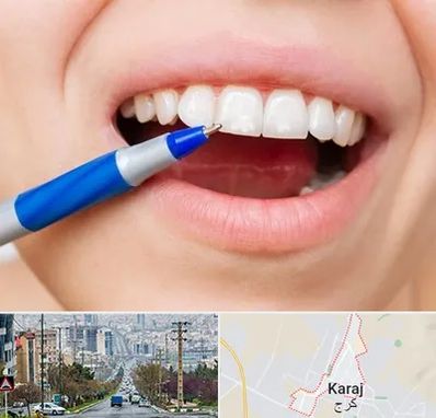 دندانسازی ارزان در گوهردشت کرج 