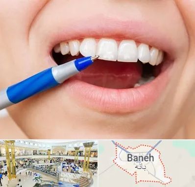 دندانسازی ارزان در بانه