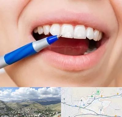 دندانسازی ارزان در رودهن