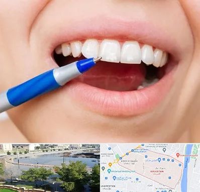 دندانسازی ارزان در گلستان اهواز 