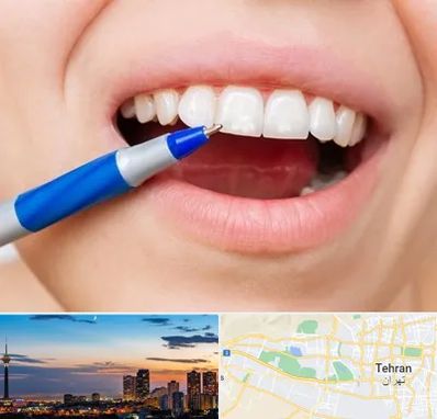 دندانسازی ارزان در غرب تهران 