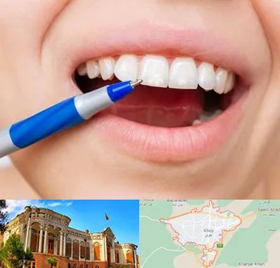 دندانسازی ارزان در خوی