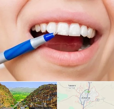 دندانسازی ارزان در کامیاران