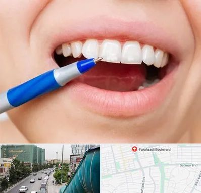 دندانسازی ارزان در بلوار فرحزادی