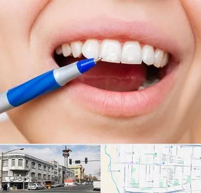 دندانسازی ارزان در 17شهریور