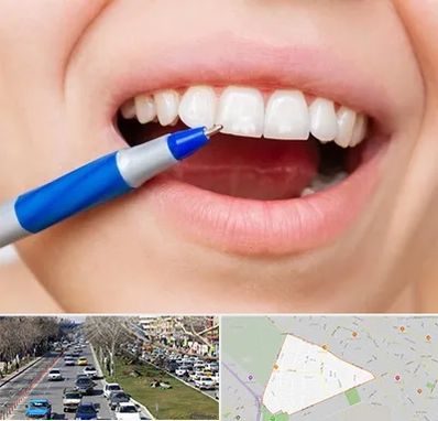 دندانسازی ارزان در احمدآباد مشهد 