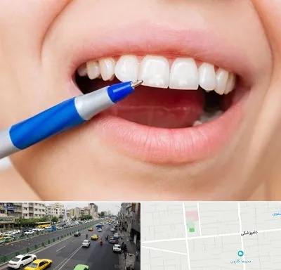 دندانسازی ارزان در خیابان دامپزشکی