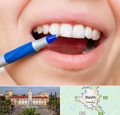 دندانسازی ارزان در رشت