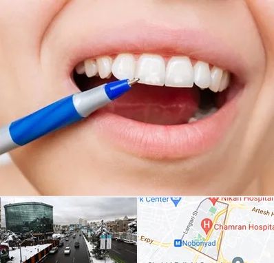 دندانسازی ارزان در اقدسیه 