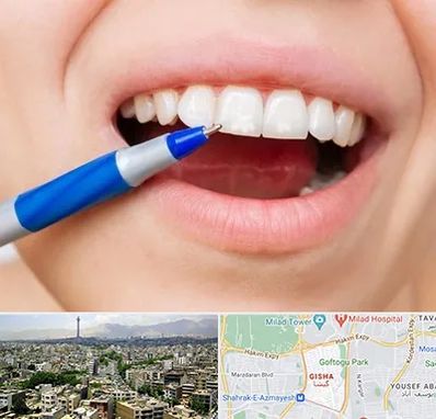 دندانسازی ارزان در گیشا 