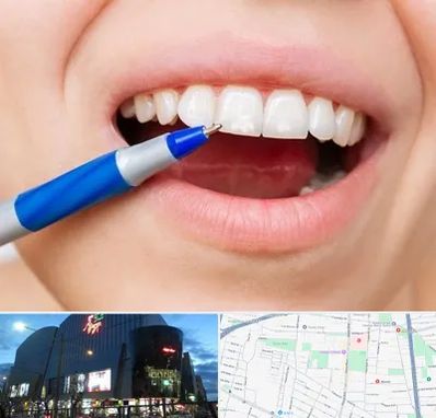 دندانسازی ارزان در بلوار اباذر