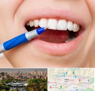 دندانسازی ارزان در منطقه 1 تهران 