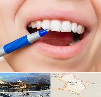 دندانسازی ارزان در ملایر