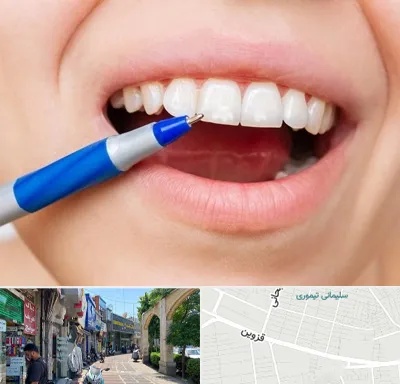 دندانسازی ارزان در خیابان قزوین