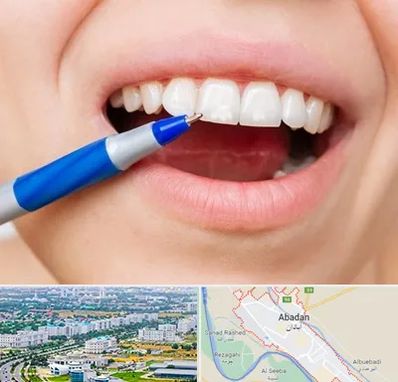 دندانسازی ارزان در آبادان