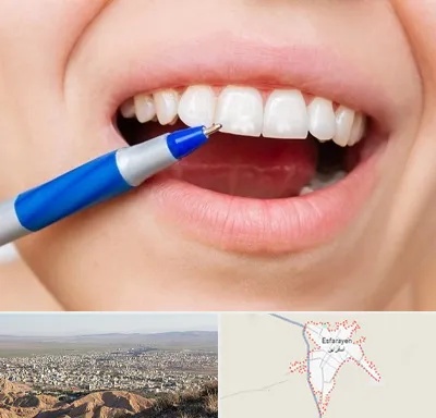دندانسازی ارزان در اسفراین