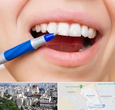 دندانسازی ارزان در ولنجک 