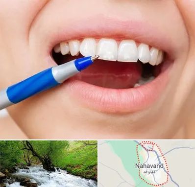 دندانسازی ارزان در نهاوند