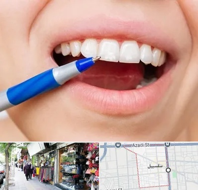 دندانسازی ارزان در سلسبیل