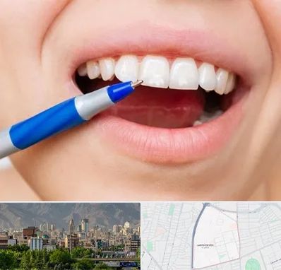 دندانسازی ارزان در جمشیدیه