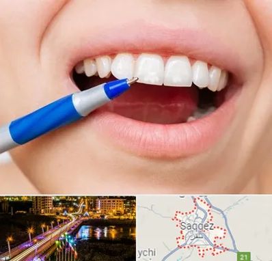 دندانسازی ارزان در سقز