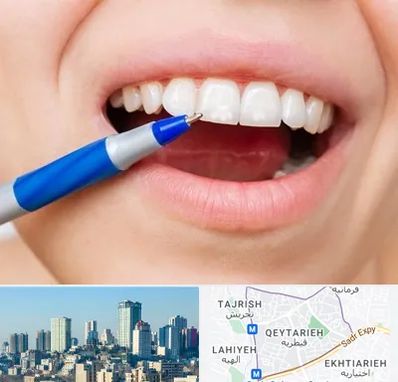 دندانسازی ارزان در قیطریه 