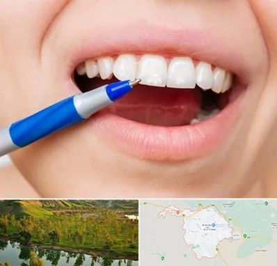 دندانسازی ارزان در بهبهان