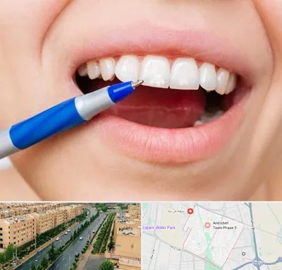 دندانسازی ارزان در فاز سه اندیشه