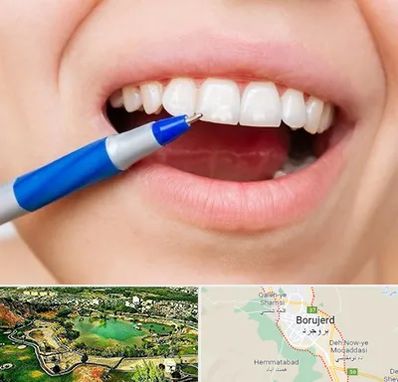 دندانسازی ارزان در بروجرد