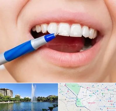 دندانسازی ارزان در کوهسنگی مشهد 