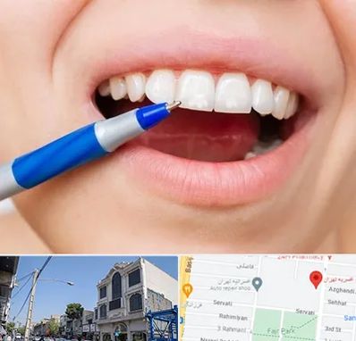 دندانسازی ارزان در افسریه 