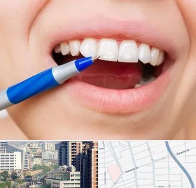 دندانسازی ارزان در خیابان بهشتی