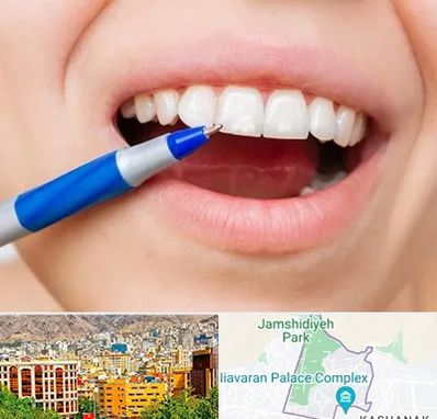 دندانسازی ارزان در نیاوران 