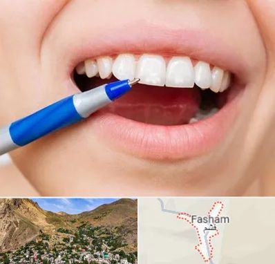 دندانسازی ارزان در فشم