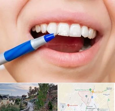 دندانسازی ارزان در باغستان کرج 