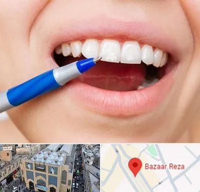 دندانسازی ارزان در بازار رضا مشهد