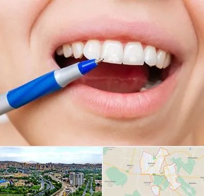 دندانسازی ارزان در شهریار