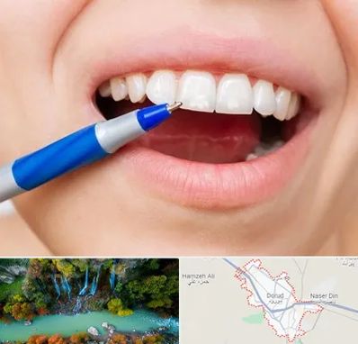 دندانسازی ارزان در دورود