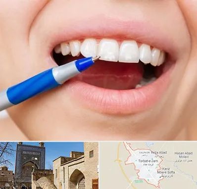 دندانسازی ارزان در تربت جام